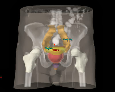 Prostata urinare cu miros neplacut Pagina 14